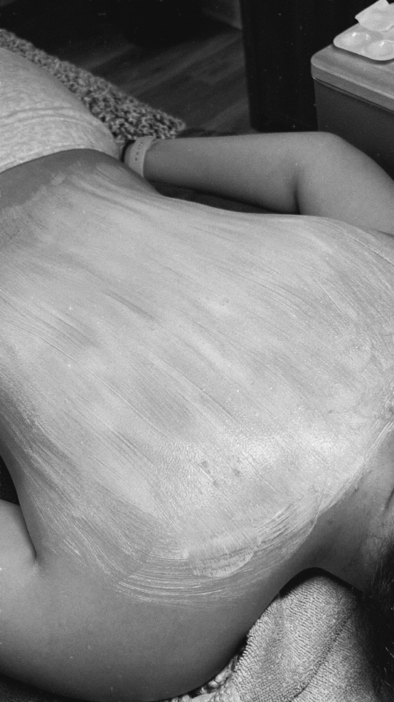 Back Facial at jaliahesthetics in Fitchburg, MA