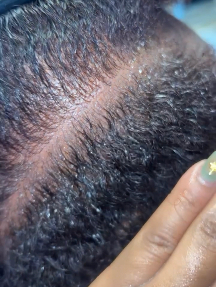 Scalp Sugar scrub