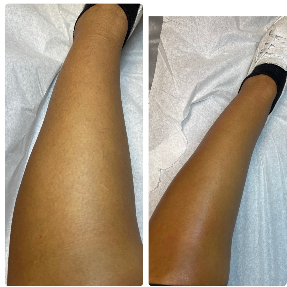 Leg Wax