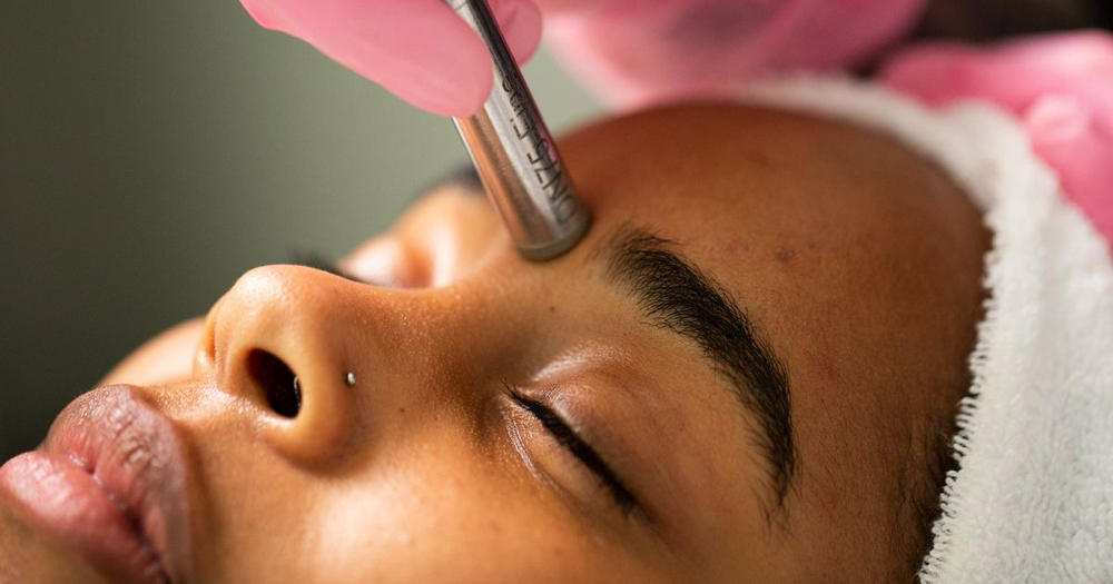 Microdermabrasion Facial