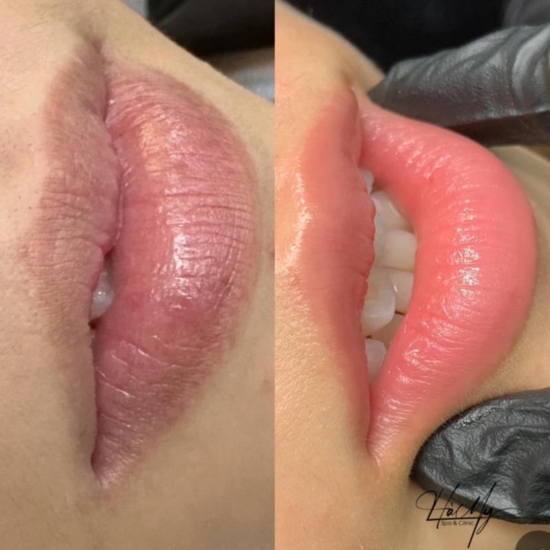 Dark Lip Correction at DBW BROW ARTISTRY in City of Industry, CA