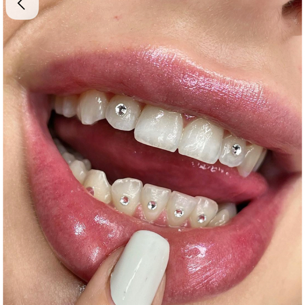 Tooth Gem at Body Contouring & More in Modesto, CA