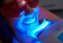 Teeth Whitening 3 Sessions