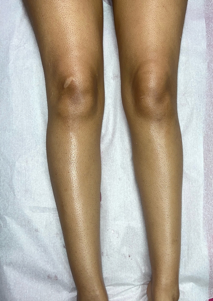 Full Leg Wax
