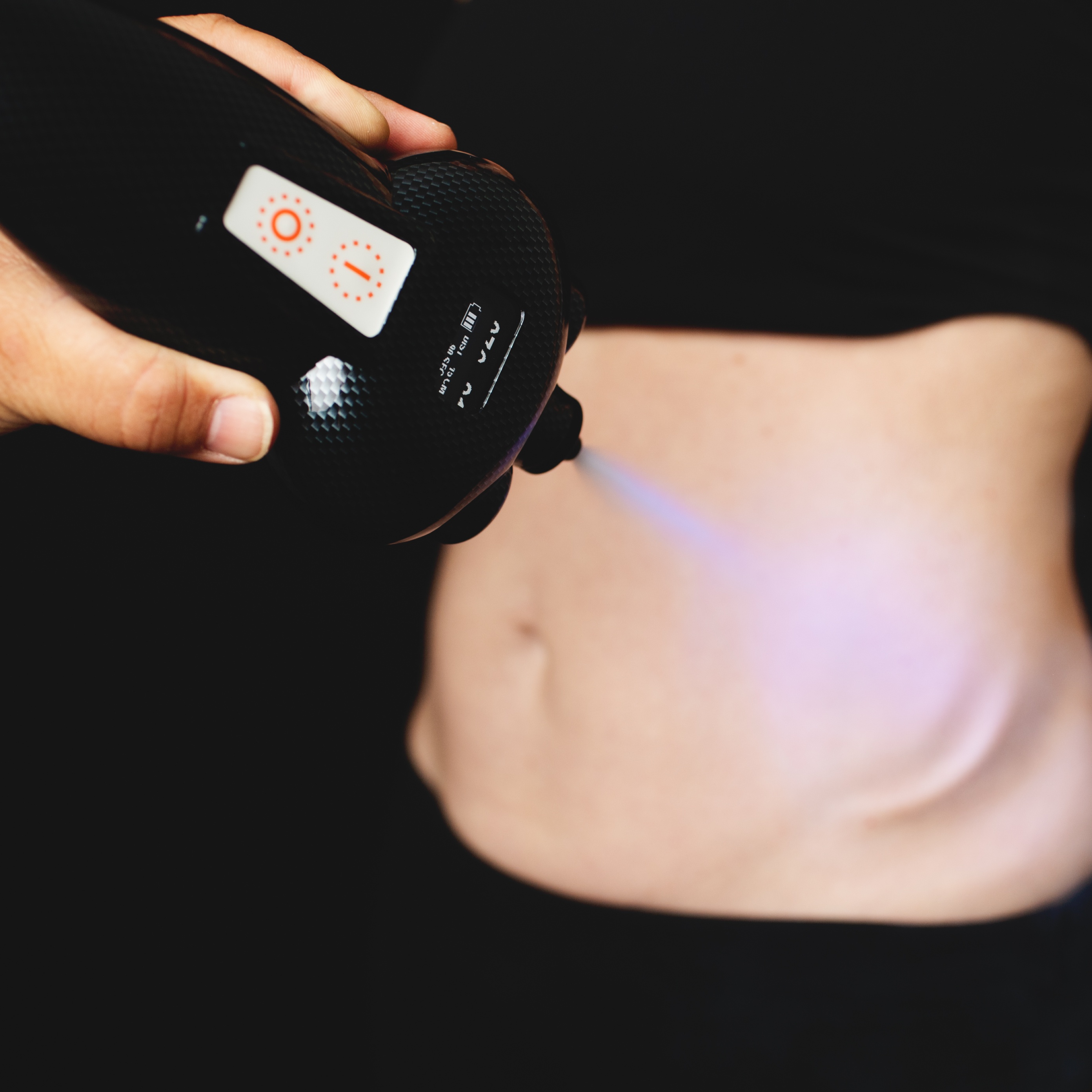 Cryotherapy Abdominal Sculpt