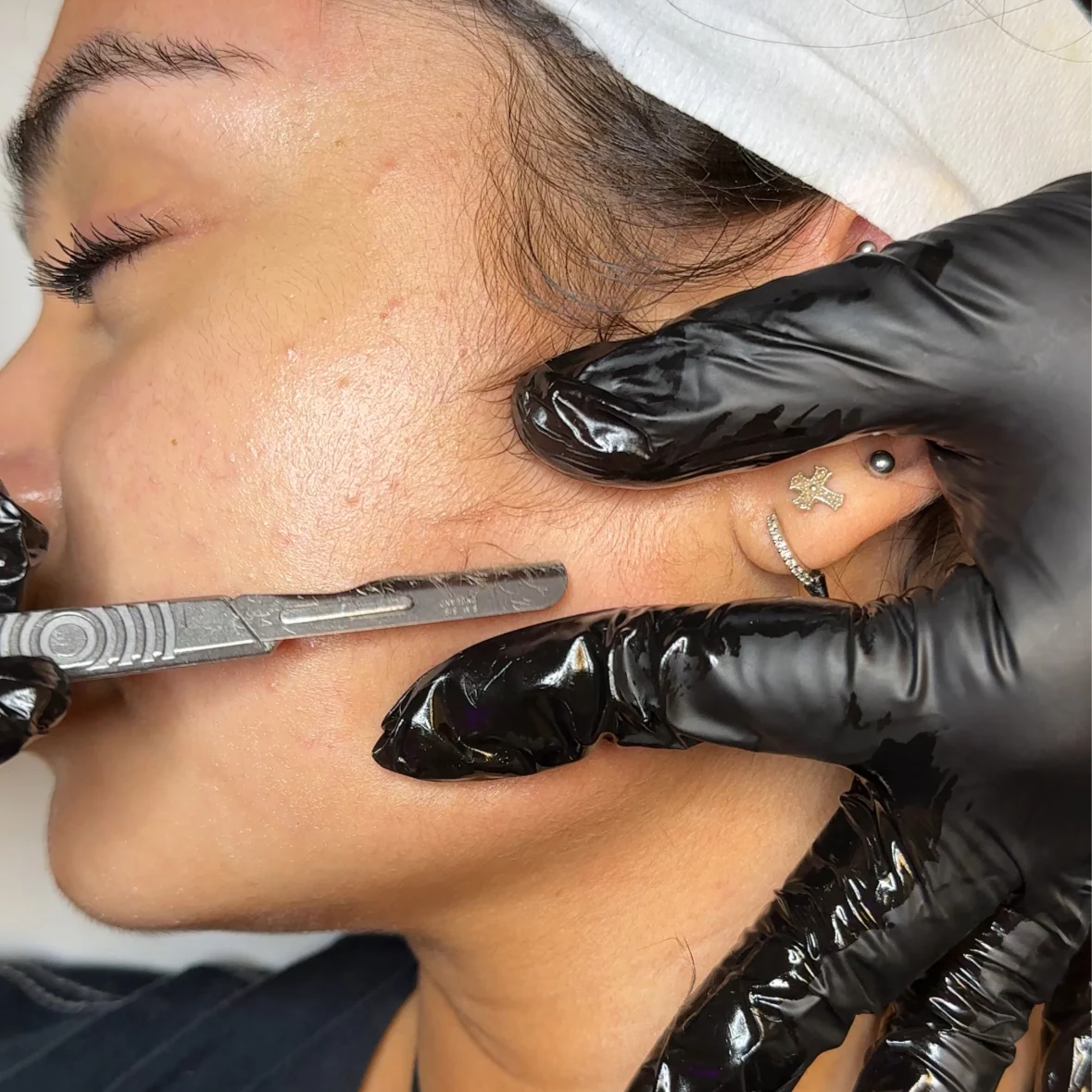 Signature Facial W/Dermaplane