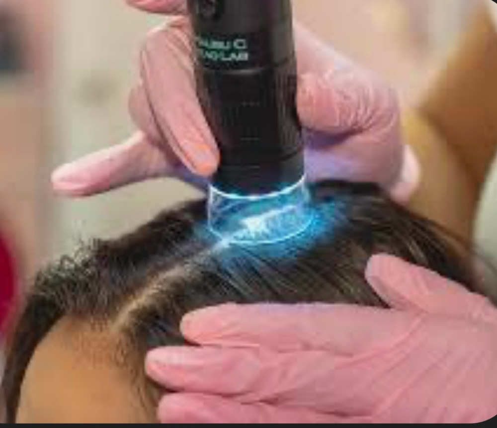 Scalp Analysis With pictures
