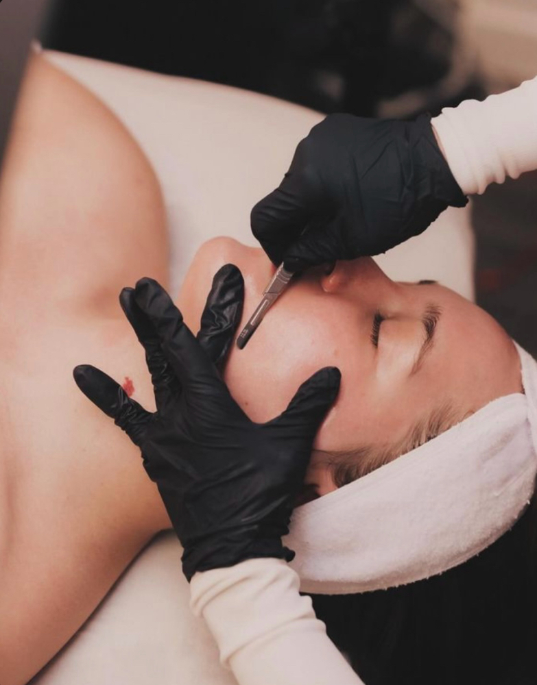 Dermaplane Facial