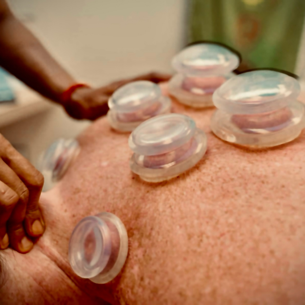 Add On- Cupping Therapy