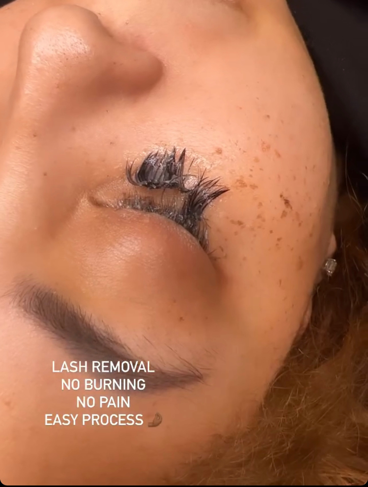 Lash Removal