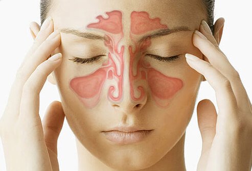 30 Eucalyptus Sinus Relief Massage