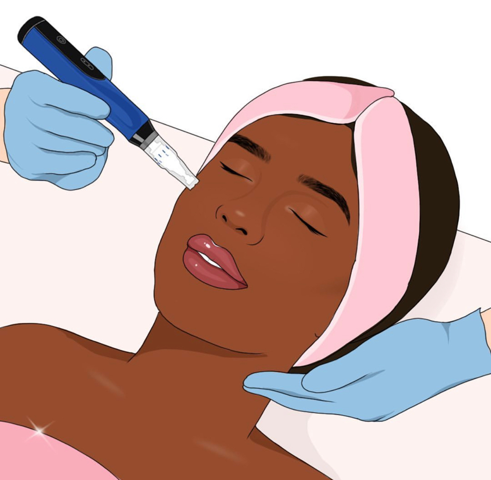 SkinPen Microneedling Neck