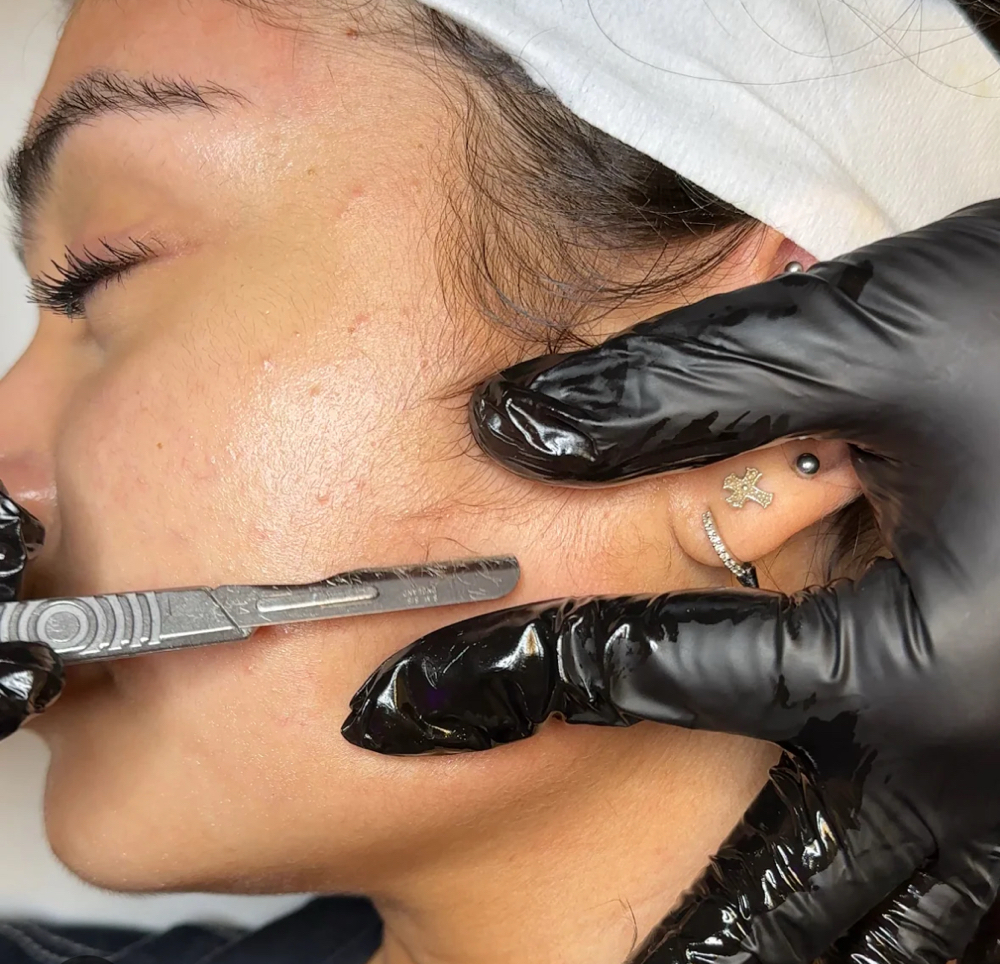 Dermaplane - Add On at Glory Esthetics in Riverside, CA