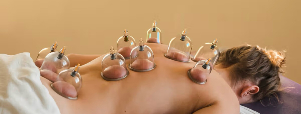 Cupping Therapy