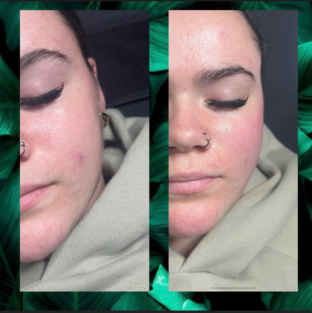 Derma Glow Facial