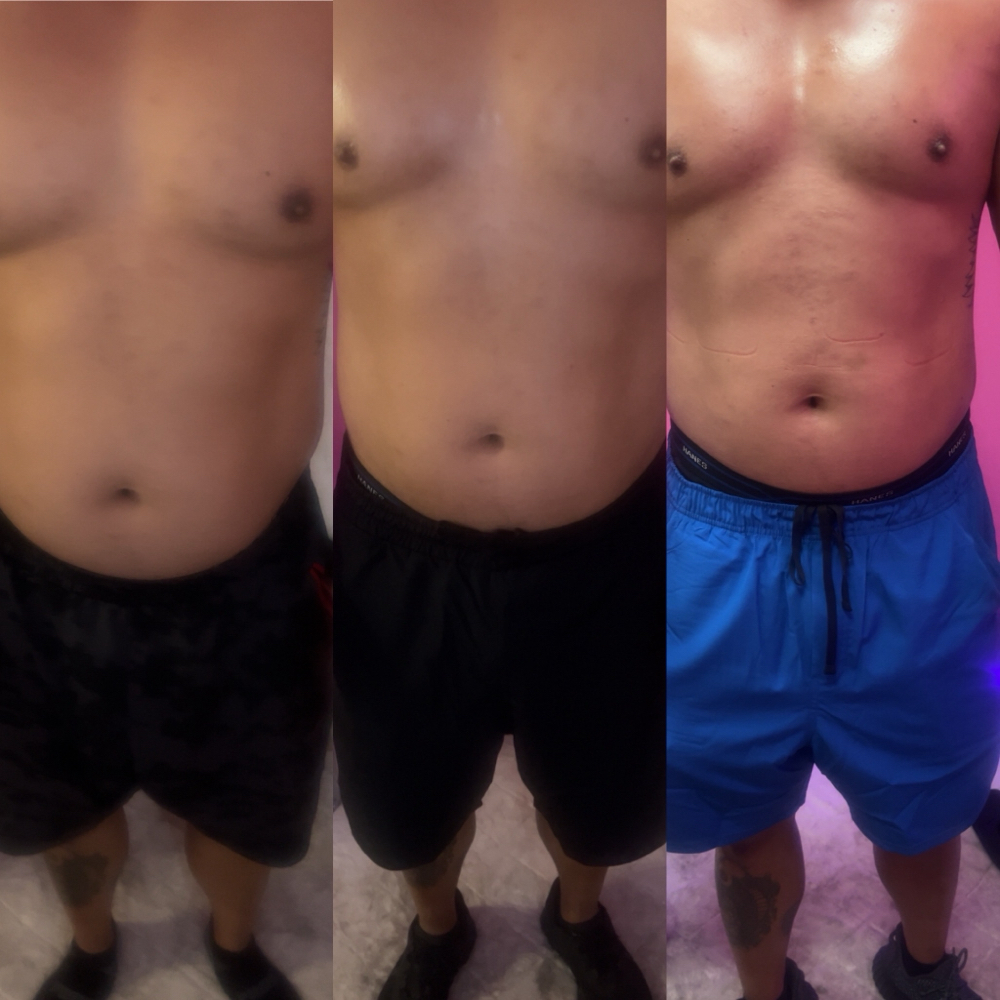 Body Sculpting 3 Session