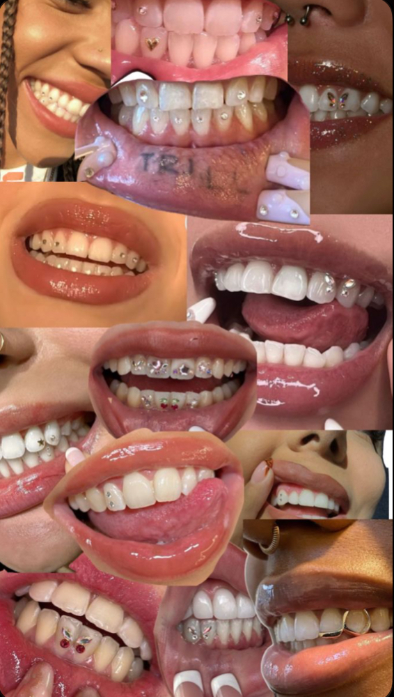 Tooth Gems