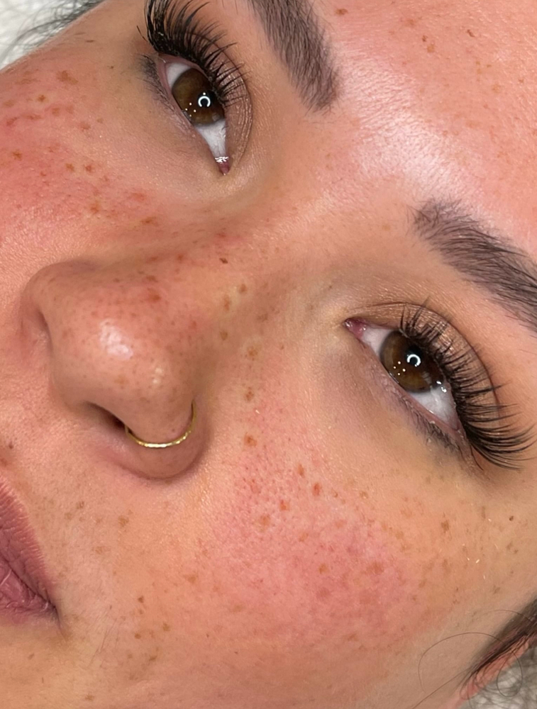 Faux Freckles