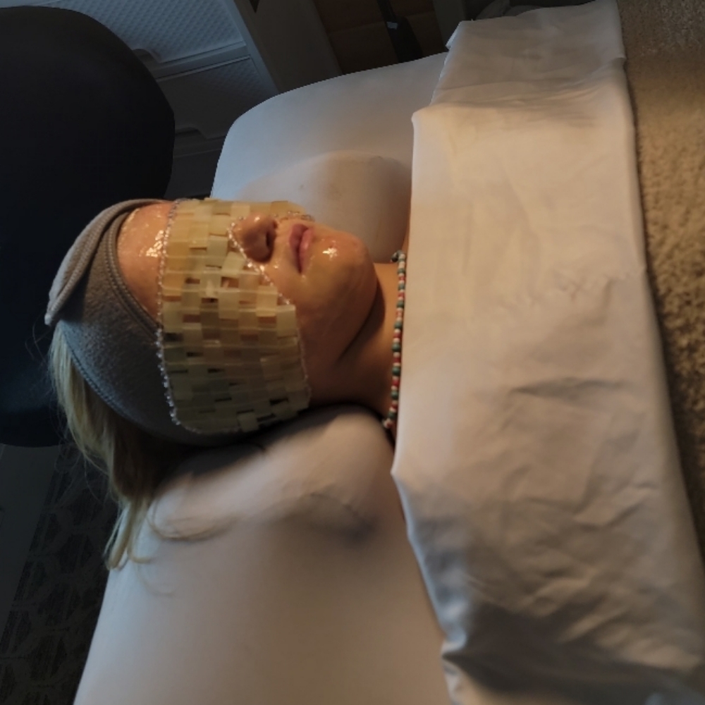 Mini Me at Timeless Esthetics in Springfield, MO
