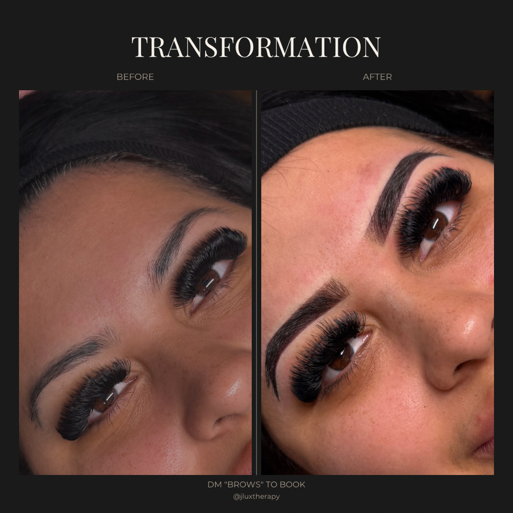 Previous Work / Correction at Jlux Therapy in North Richland Hills, TX