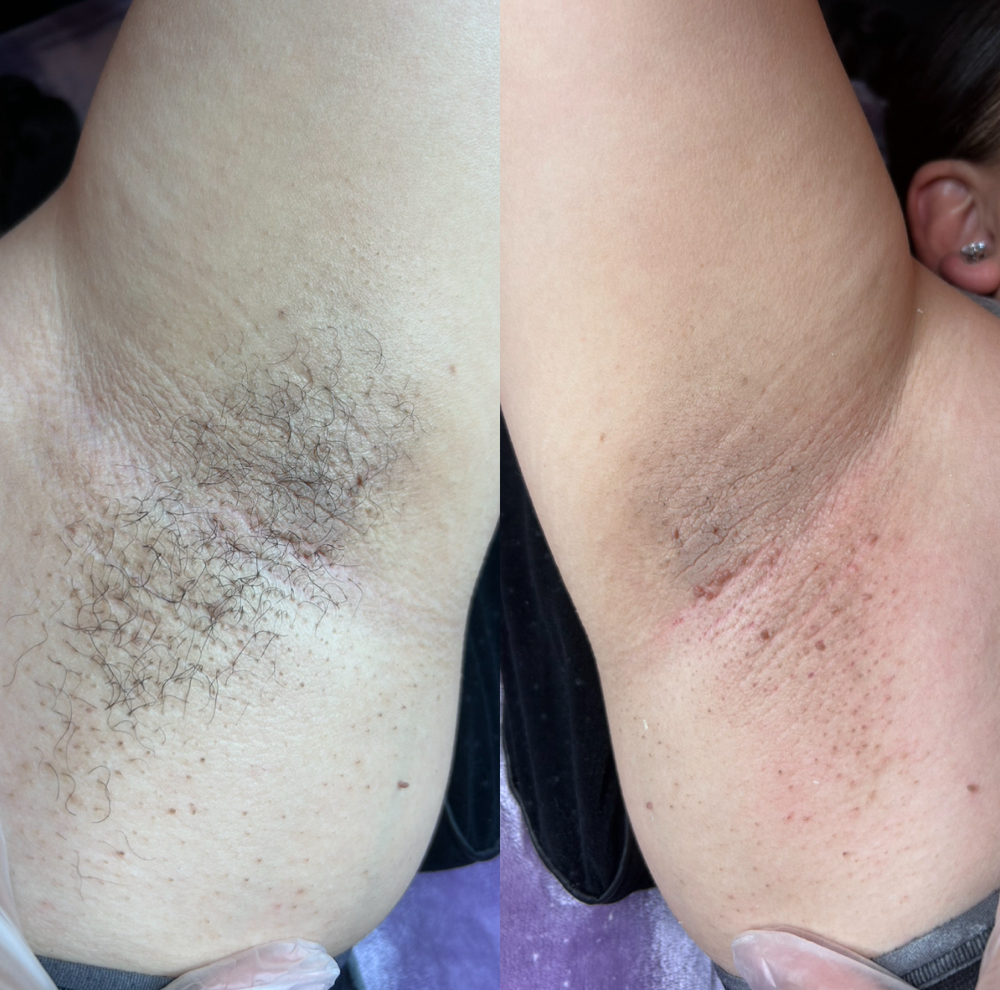 Underarm Waxing