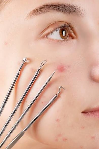 Extractions