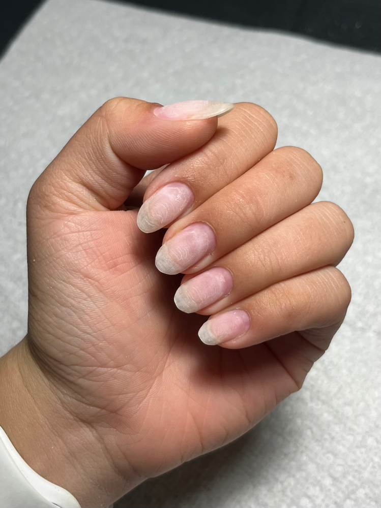 GEL REMOVAL