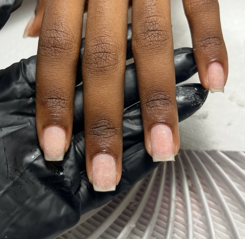 GEL REMOVAL