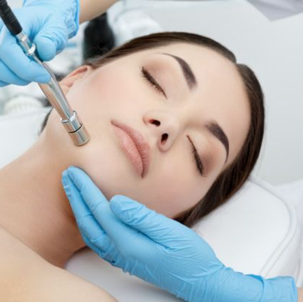 Microdermabrasion at Vanessa Yarce in Miami, FL