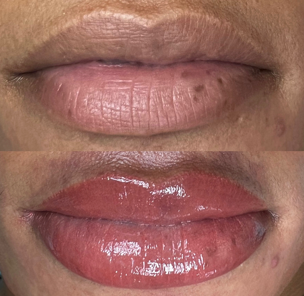 Lip Neutralization