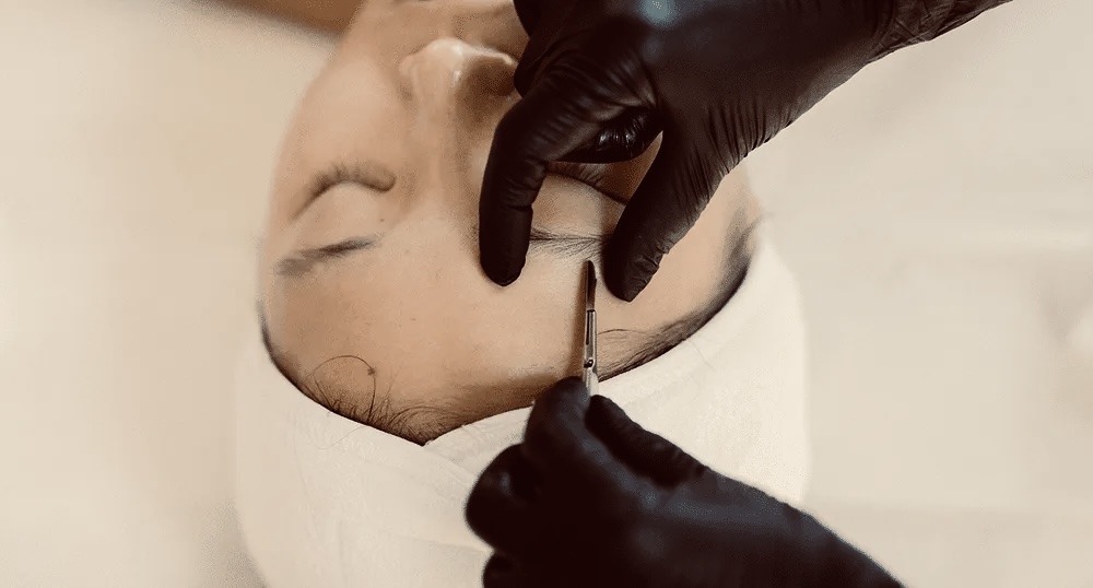 DERMAPLANE  PRO FACIAL