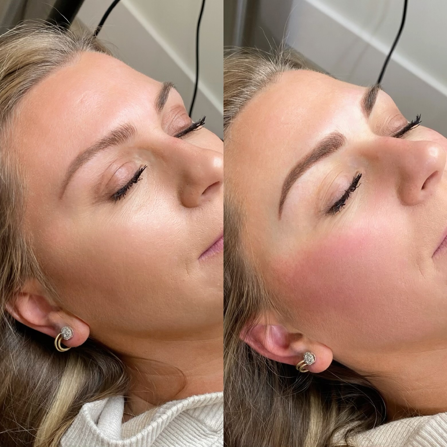 18-30 Month Touch Up-