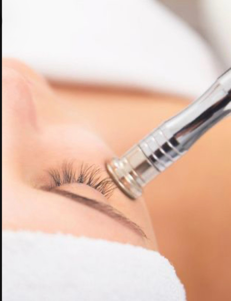 Microdermabrasion Facial