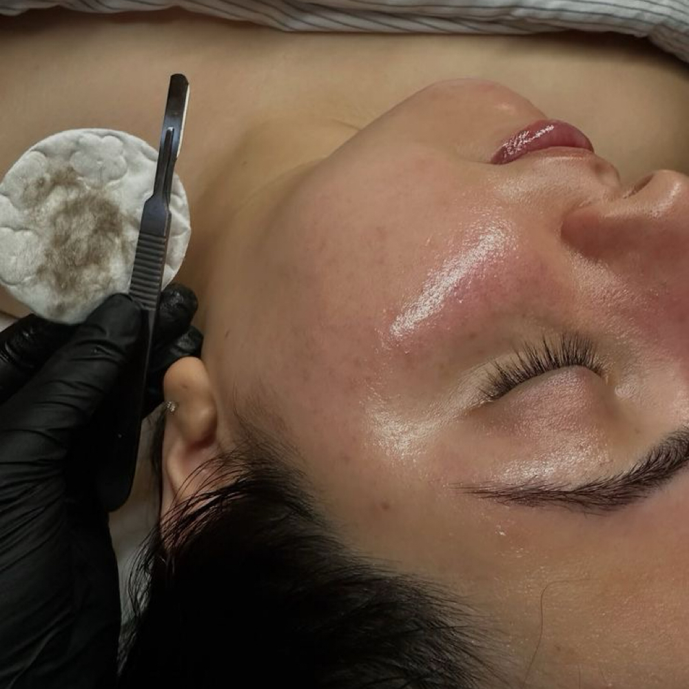 Dermaplane Express Facial at Beautified by Gabs in Prairieville, LA