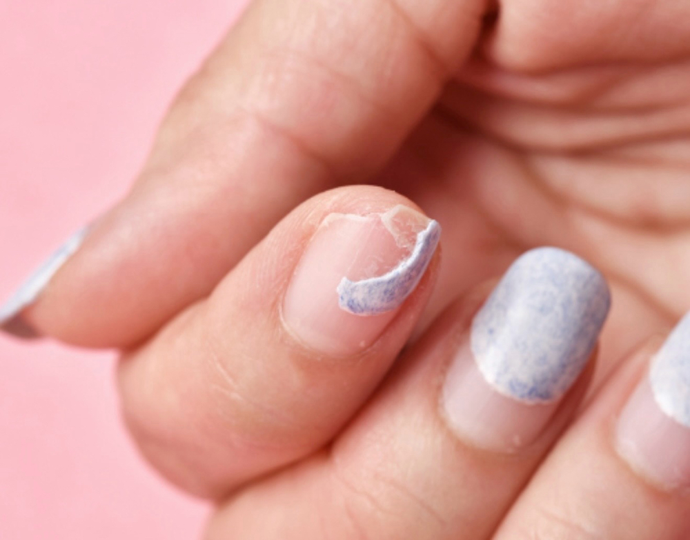 Nail Repair