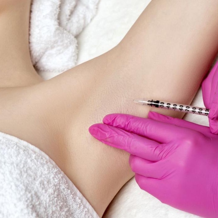 Tox For Axillary Hyperhidrosis