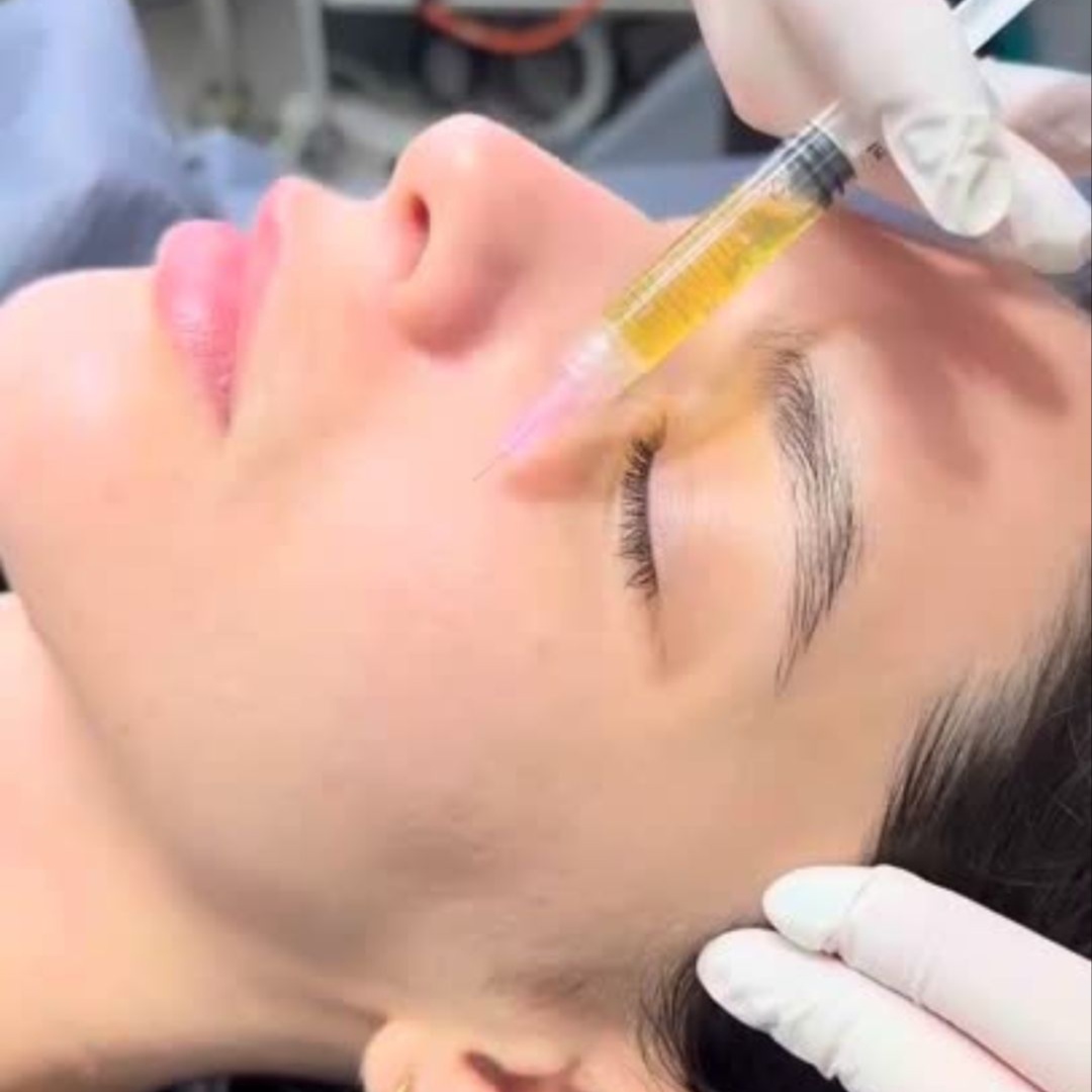 PRP Facial Therapy at Zen Essence Spa & Wellness in Brooklyn, NY