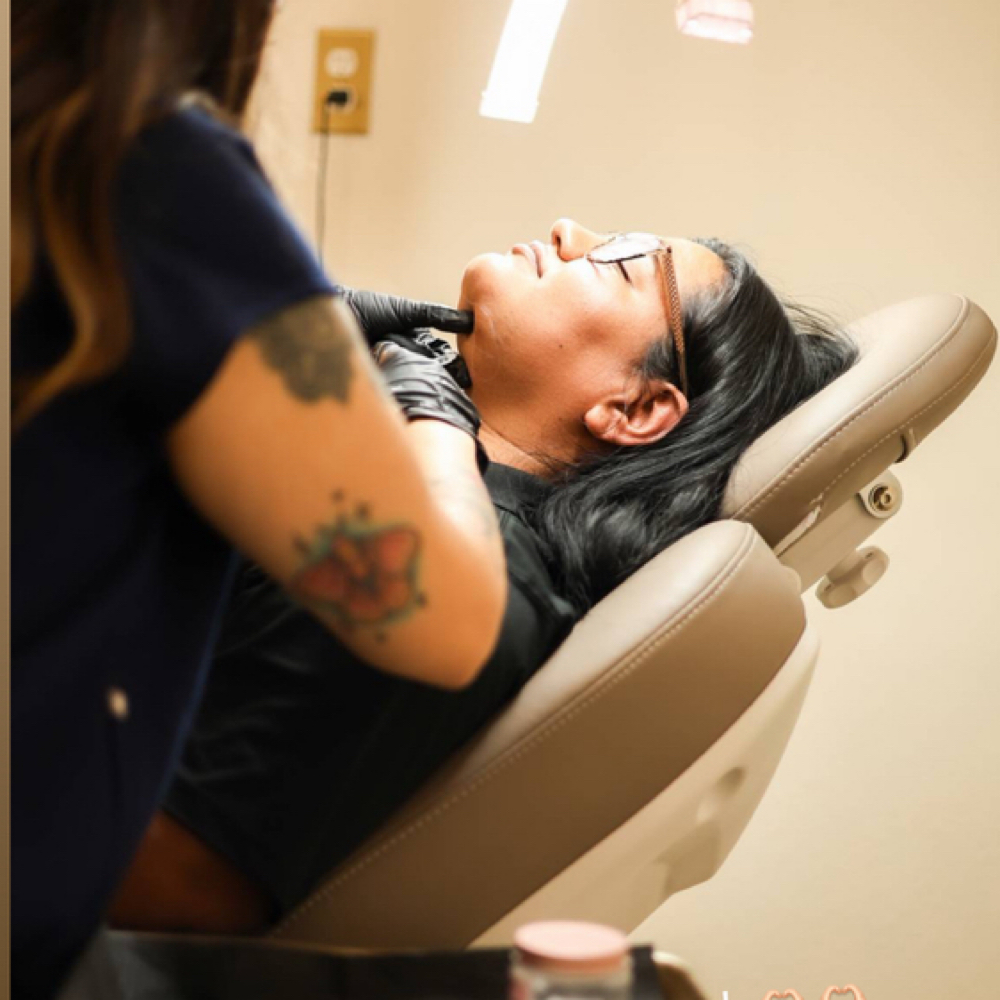 PCDC LIQUID LIPO - Love handles at Aura Skin x Marissa in Alice, TX