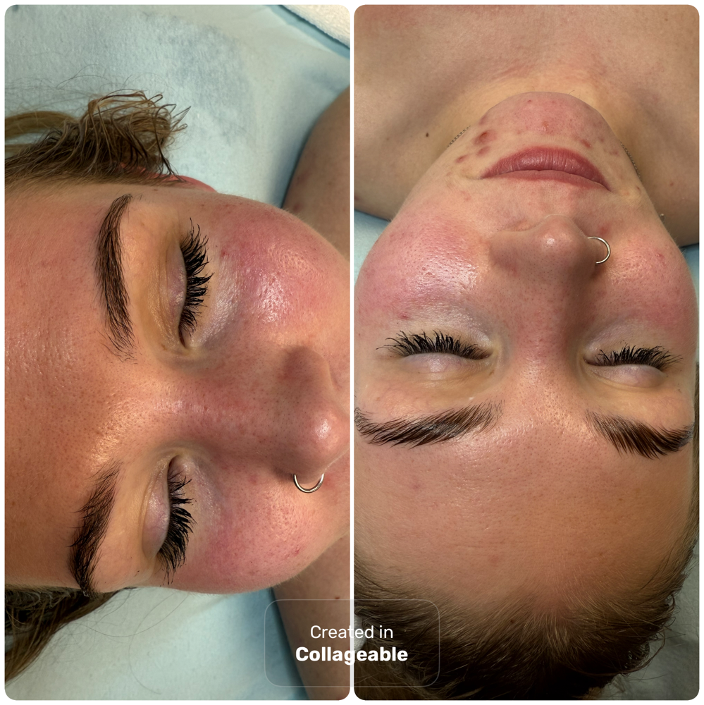 Eyebrow Lamination