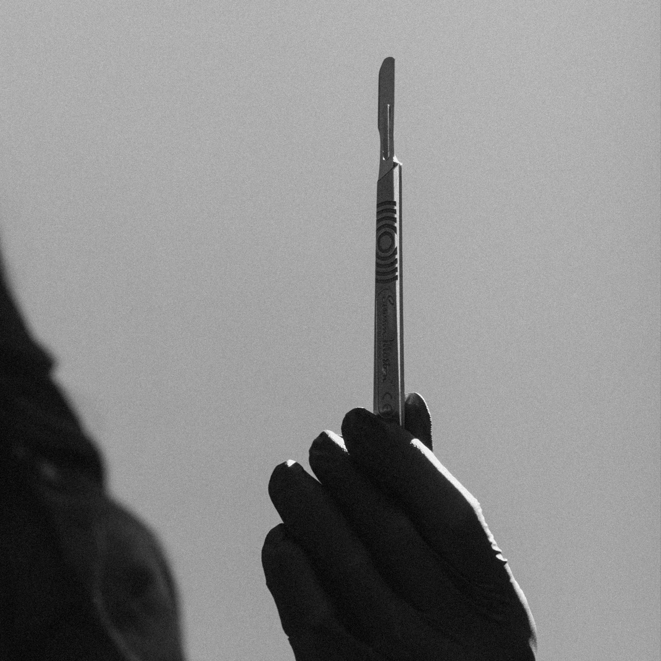 Dermaplane Add-On at Allure Aesthetics & Beauty Co in Oregon, IL