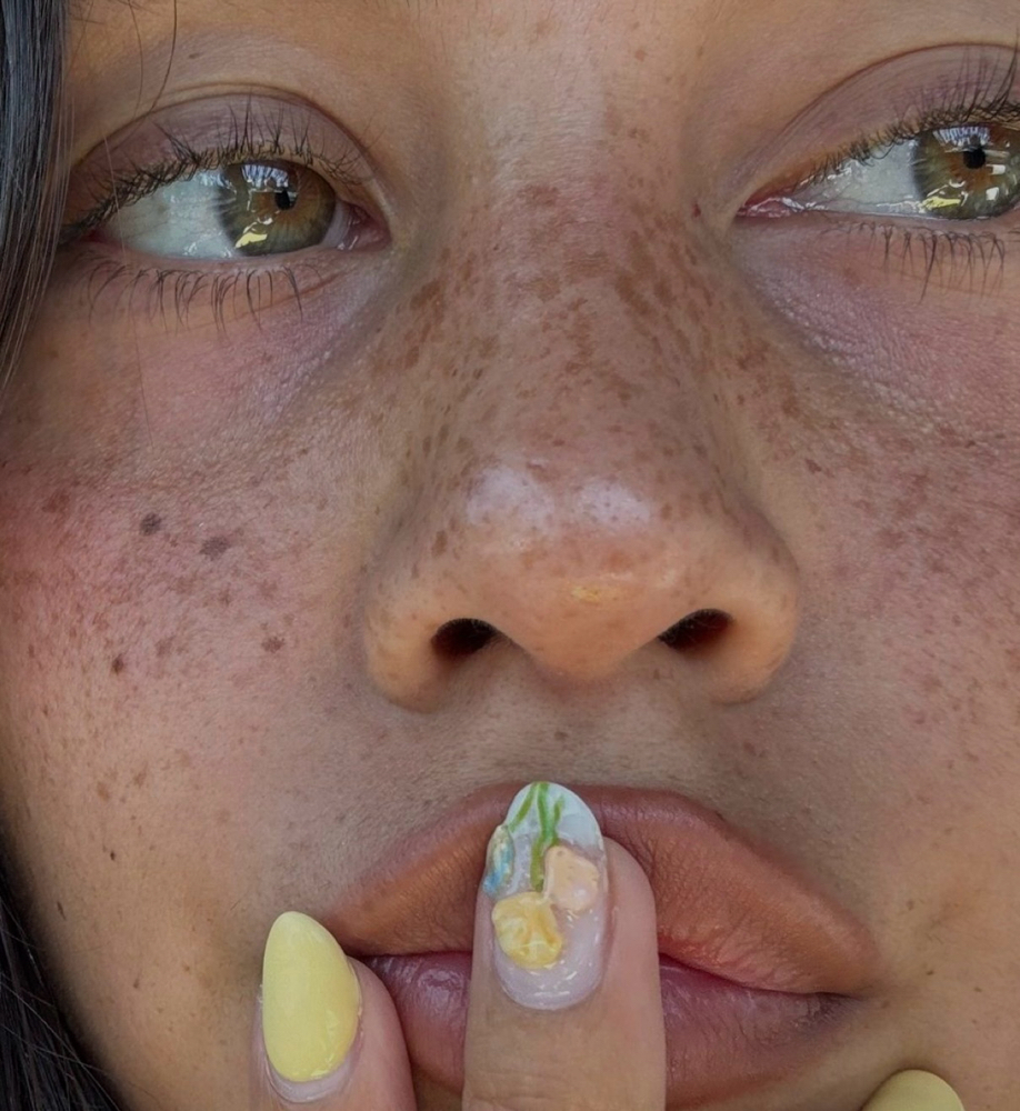 Stain Freckles