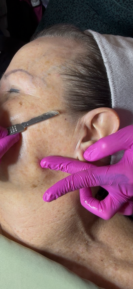 Dermaplane Add-On