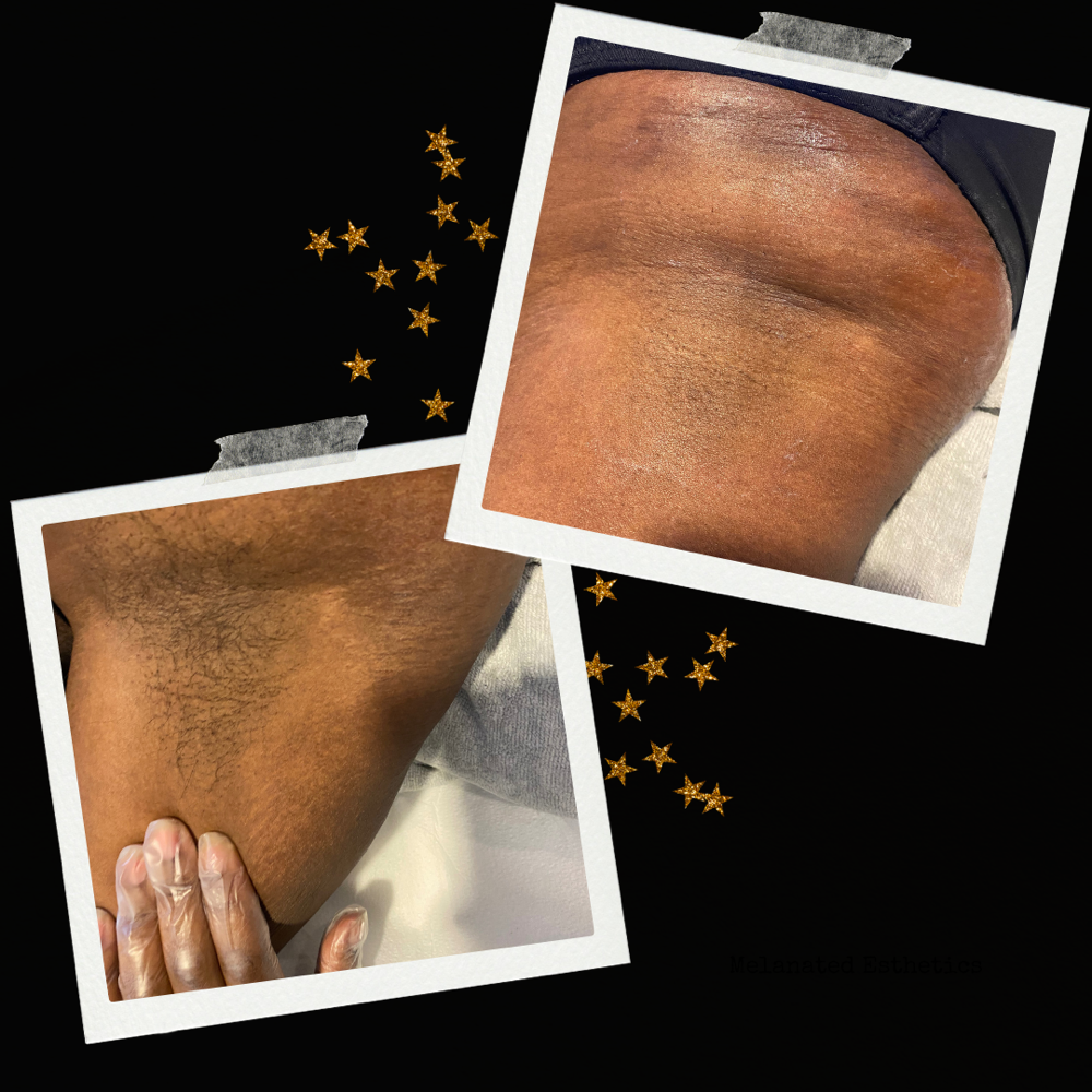Under Arm Wax