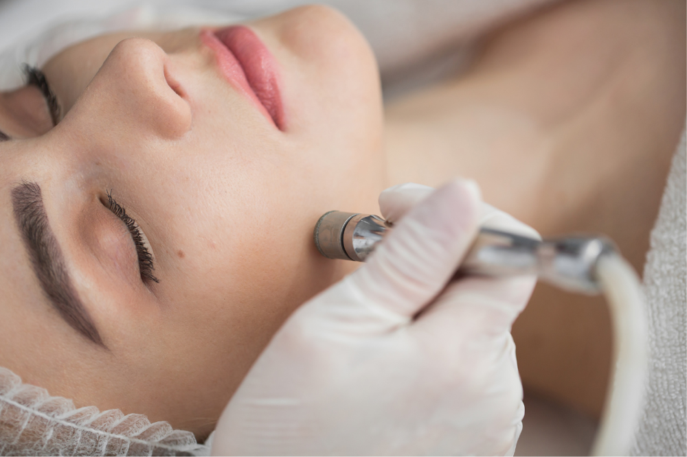 Microdermabrasion Facial