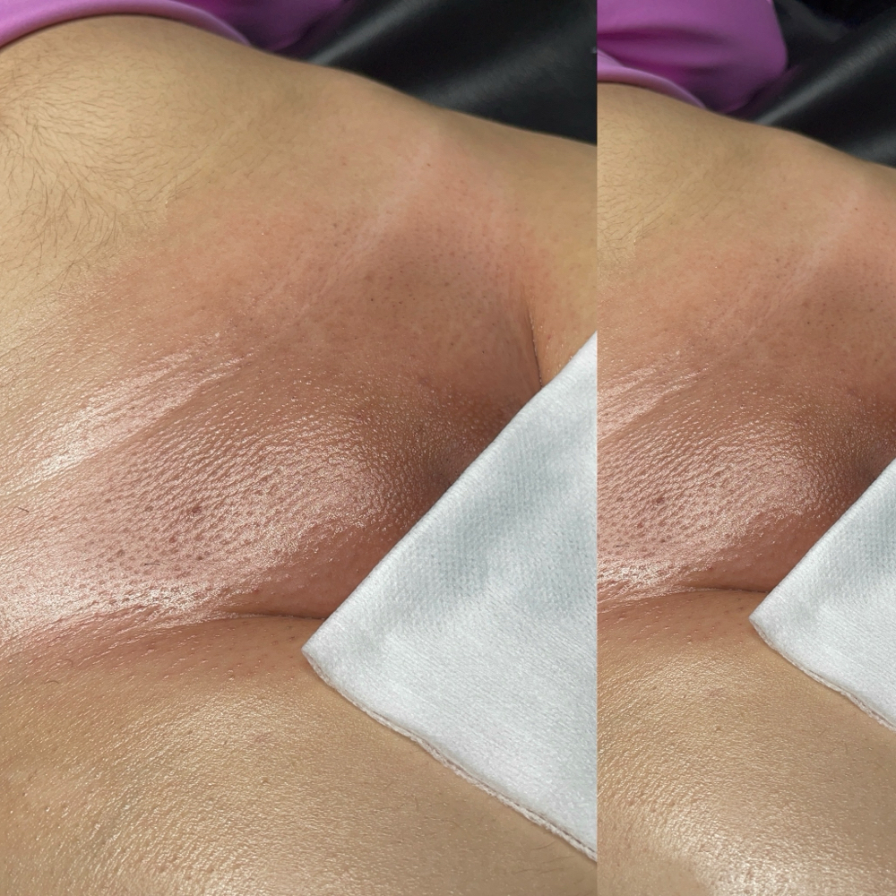 Brazilian Wax (Women Only) at Cosmic Beauty Studio LLC in Fort Worth, TX