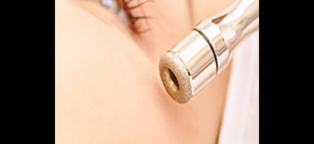 Microdermabrasion