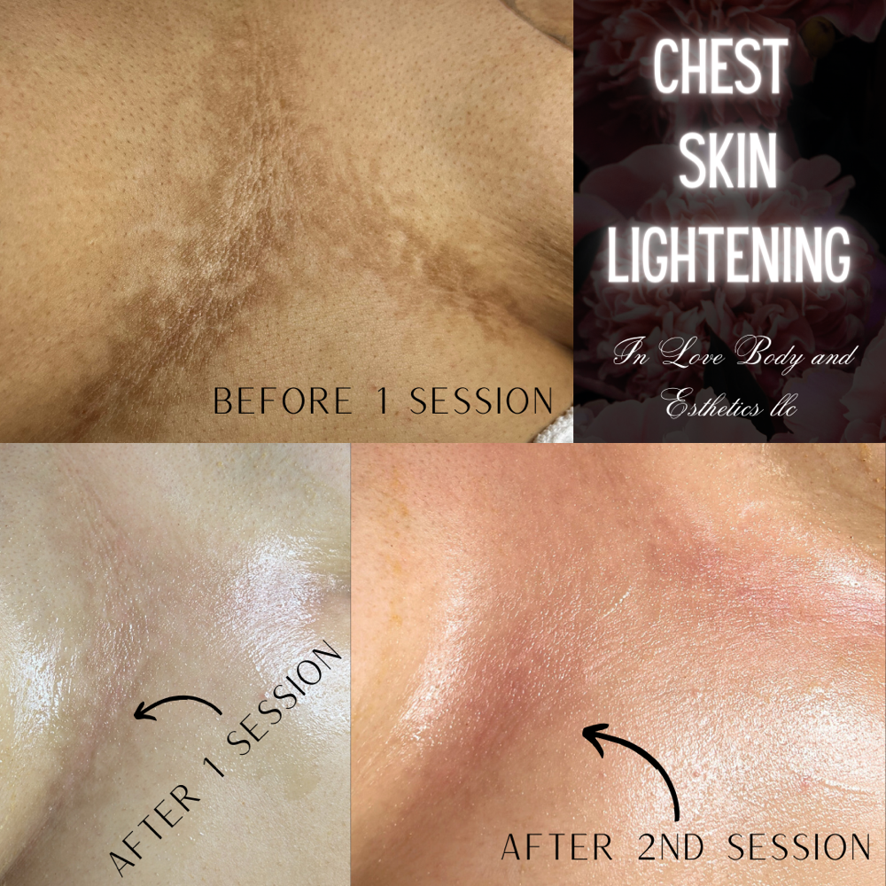 Chest Skin Correction