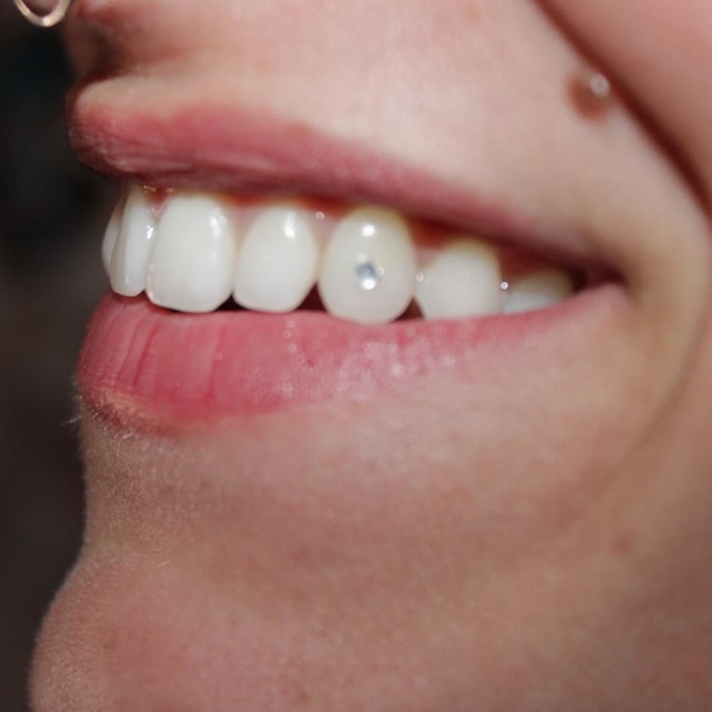 Single Tooth Gem at The Bearded Lady in Portland, OR