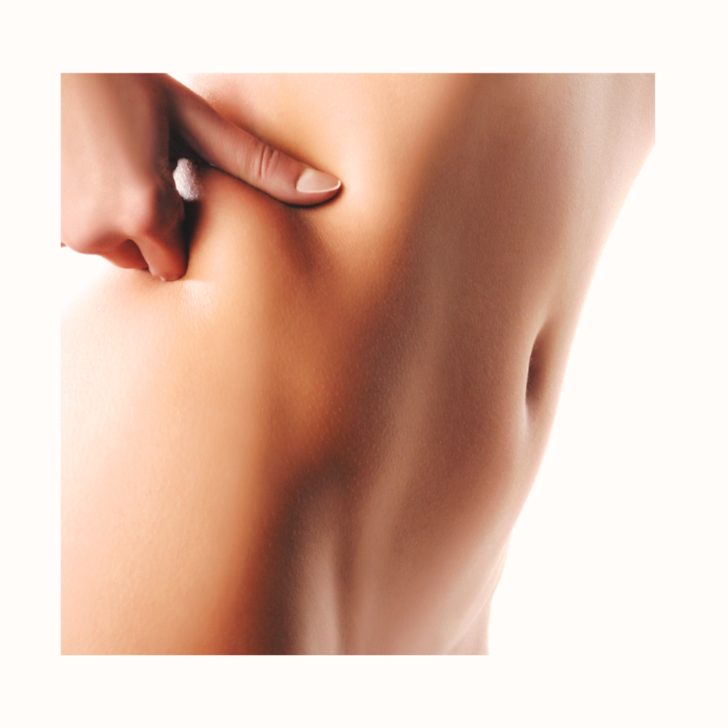 Bikini Brazilian (Women) at Bareline Aesthetics in Brea, CA