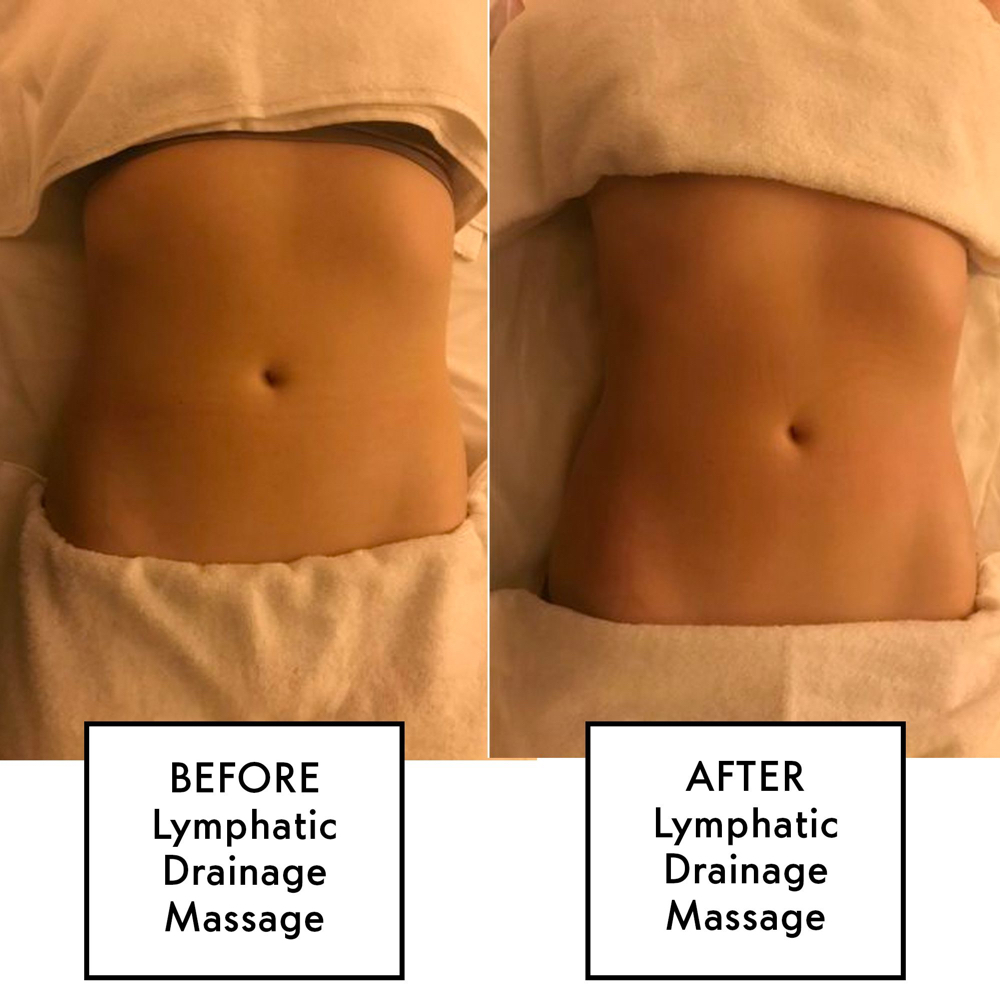 Lymphatic Drainage Massage